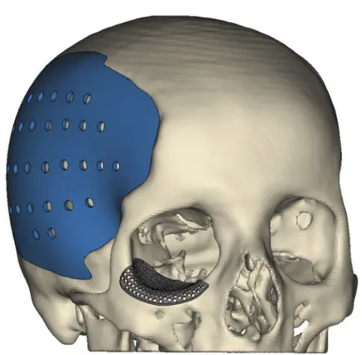 Materialise 3-matic软件